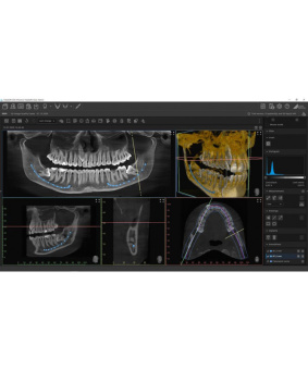 Компьютерный томограф VistaVox S (Durr Dental)